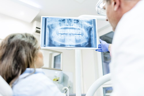 Dentist and patient looking at a dental xray.